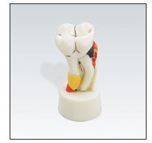 Frasaco Studie Modell Molar