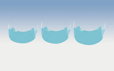 Composi-Tight clear 5,9mm pre/molar100st