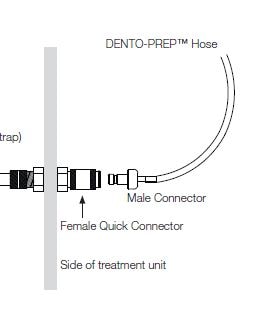 Dento-Prep Hananslutning