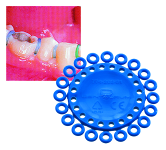 Dentalastics Separationsringar blå 1000st