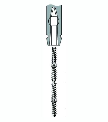 TMS Link plus Minim 2/1 Titan 24st