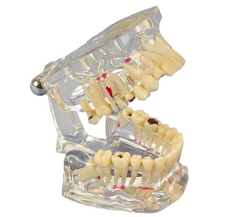 Studiemodell transparent 1:1 ÖK/UK de Luxe