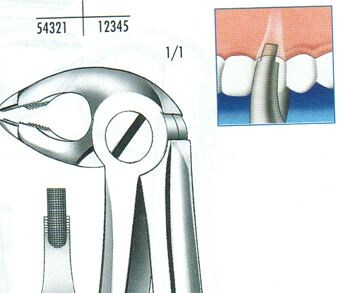 Extraktionstång M118 UK premolar