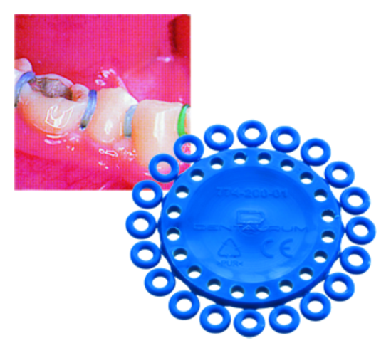 Dentalastics Separationsringar grön 1000st